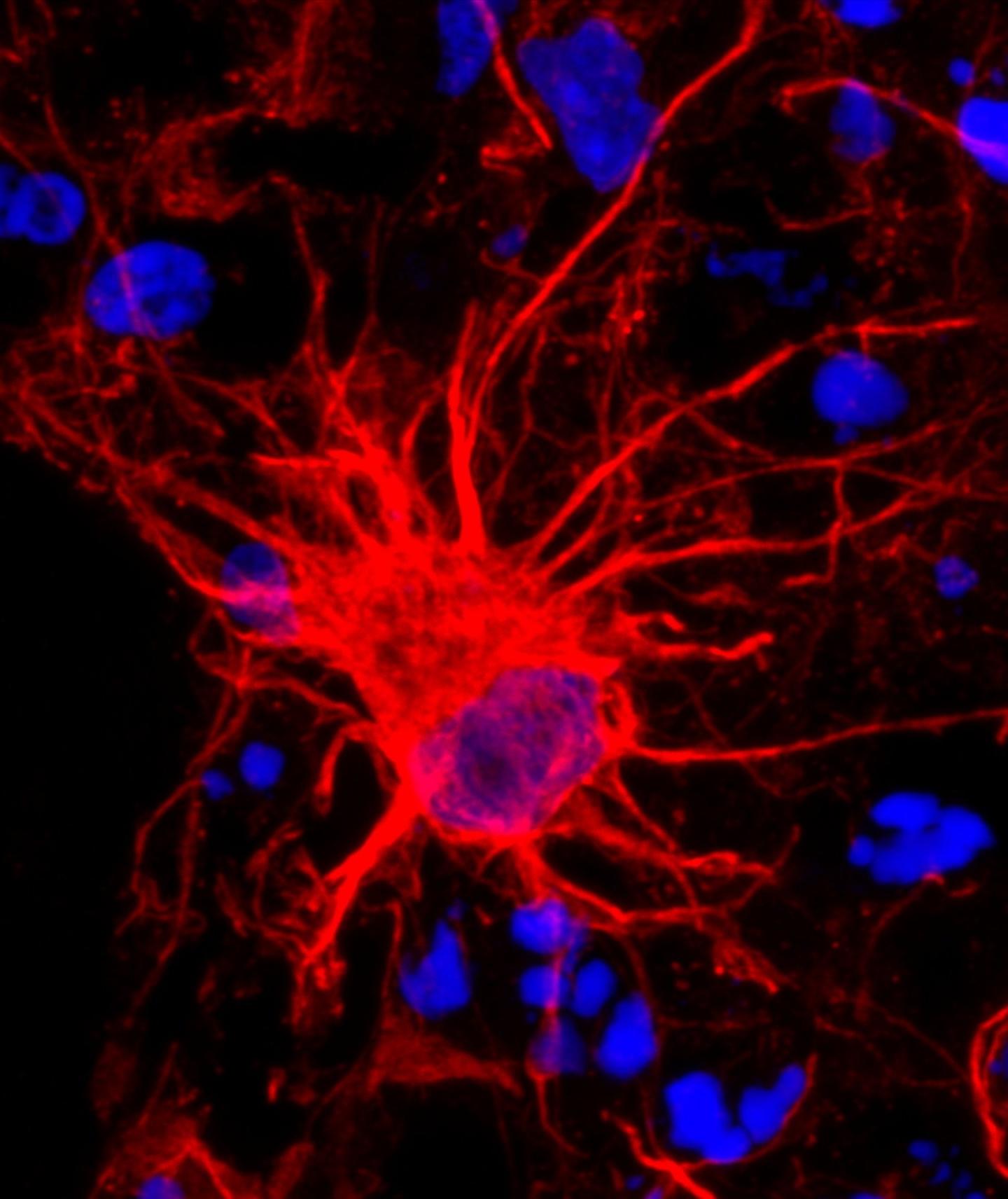 Researchers Investigate Star-Shaped Brain Cells