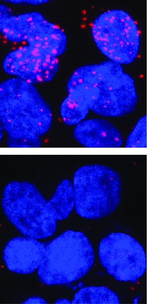 Androgen Receptor