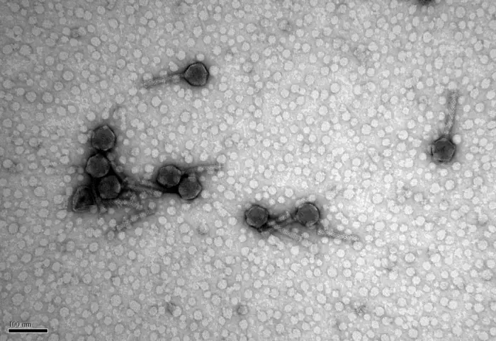 Transmission electron micrograph of tailed phages.