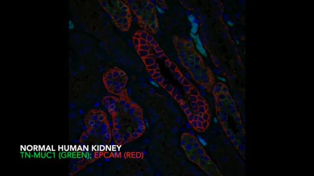 Where is Tn-MUC1 in a Cell