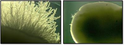 Good Yeast, Bad Yeast