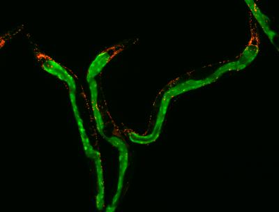 Mitochondrial Function in Intenstine and Nerve Cells