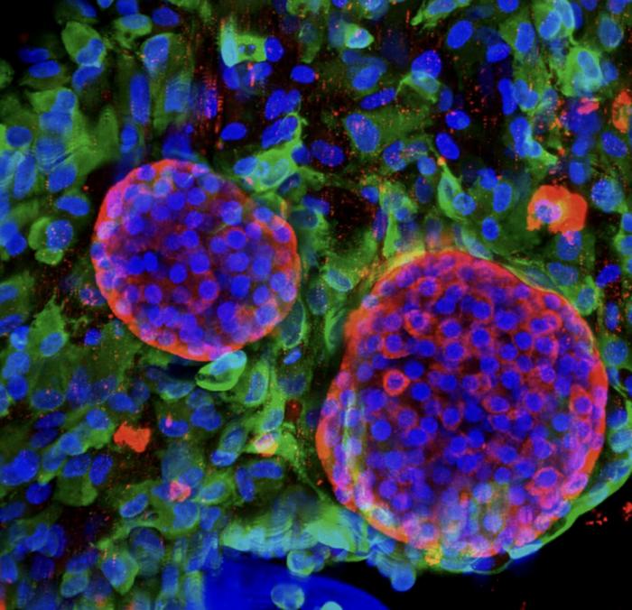 The EU highlights UNIGE’s bioartificial pancreas project