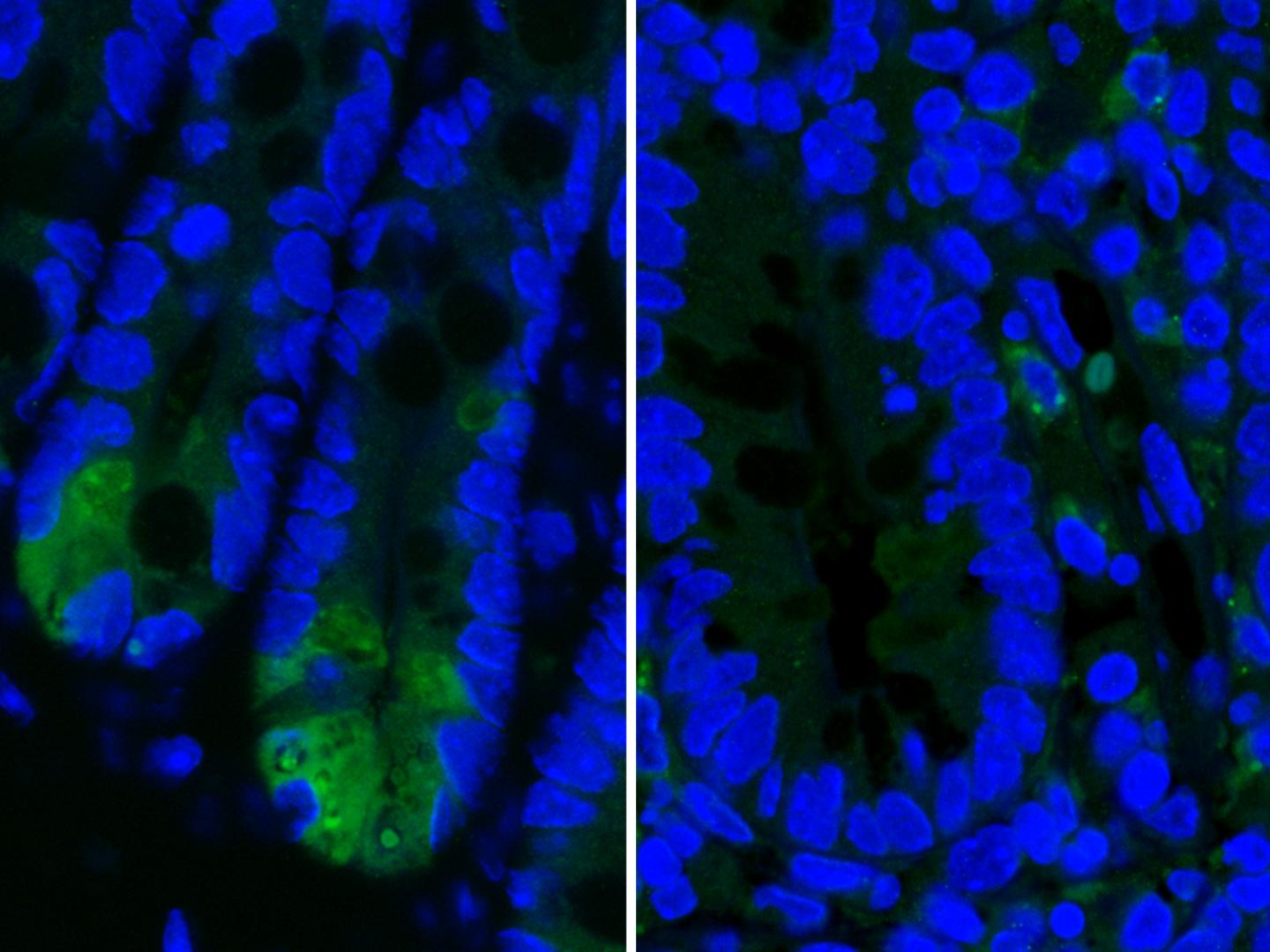 Paneth Cells