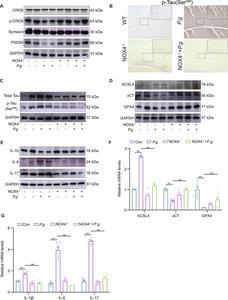 Fig.5. Nox4-/- salvages the P.g-induced ferroptosis, neuroinflammation, and pathologies.