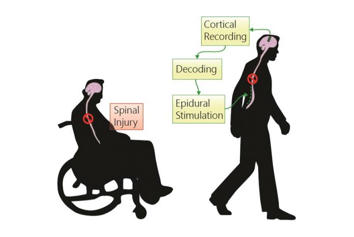 UC Davis Engineers Lead $36M Effort to Improve Recovery From Spinal Cord Injuries