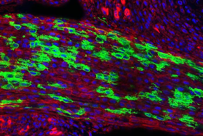 Newly Discovered Stem Cell Reveals Potential Drug Target for Spinal Stenosis