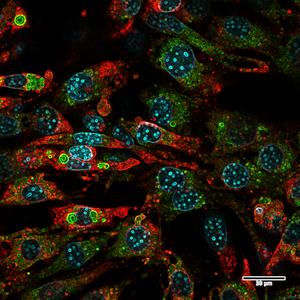 Fat cells color