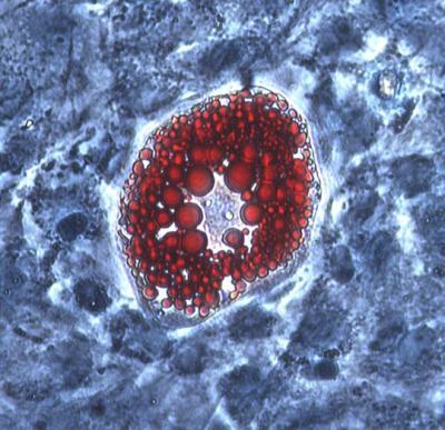 A Fat Cell Grows Up