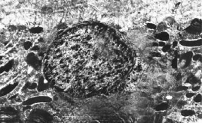 Apoptotic Features