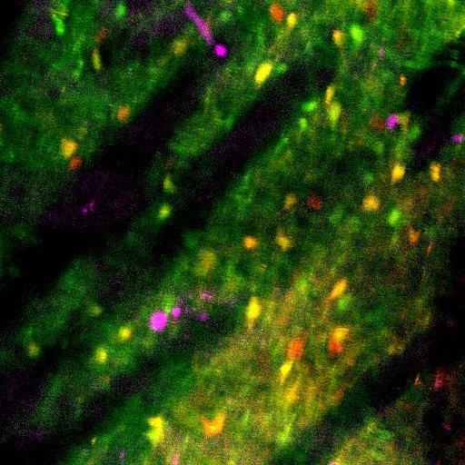 Fast-Spiking Interneurons