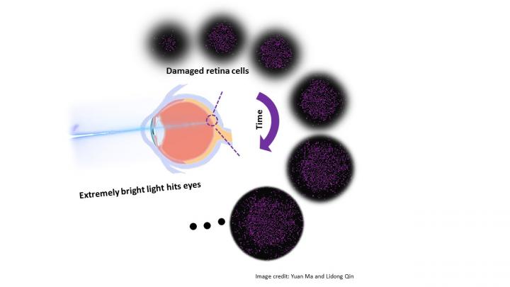 Damaged Retina Cells