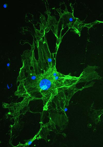 A Hepatic Stellate Cell