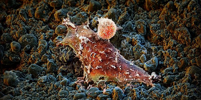 Immunotherapy