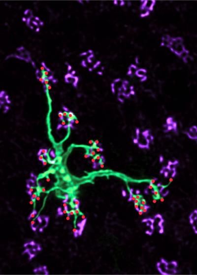 Confocal Micrograph of a Single Cone Bipolar Cell