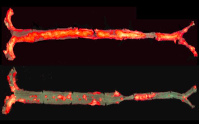 Mouse Model of Atherosclerosis