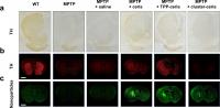 Figure 2: Mouse Brain Sections Showing Tyrosine Hydroxylase (TH,in Red) and Nanoparticles (Green)