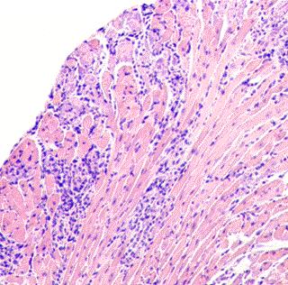 Photomicrograph 