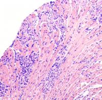 Photomicrograph 