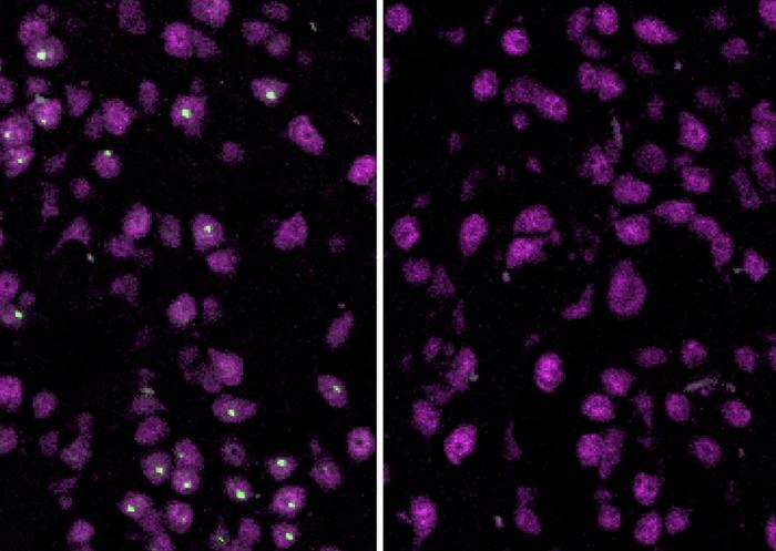 Huntington's study: Treated and untreated mouse brain cells