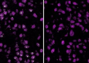 Huntington's study: Treated and untreated mouse brain cells