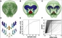 Pinpointing Where and How Many Cells in Different Regions are Active