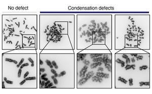Chromosomes with condensation defects