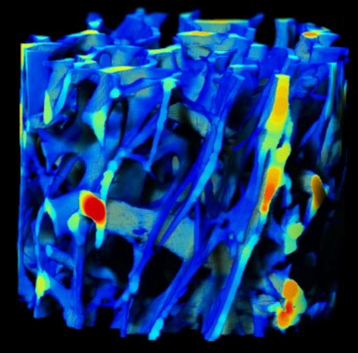 X-ray Nanotomagraphy