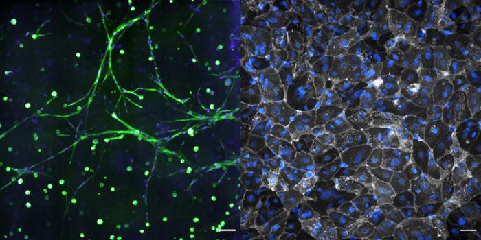 Stromal cells