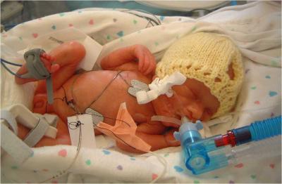 Premature Neonate
