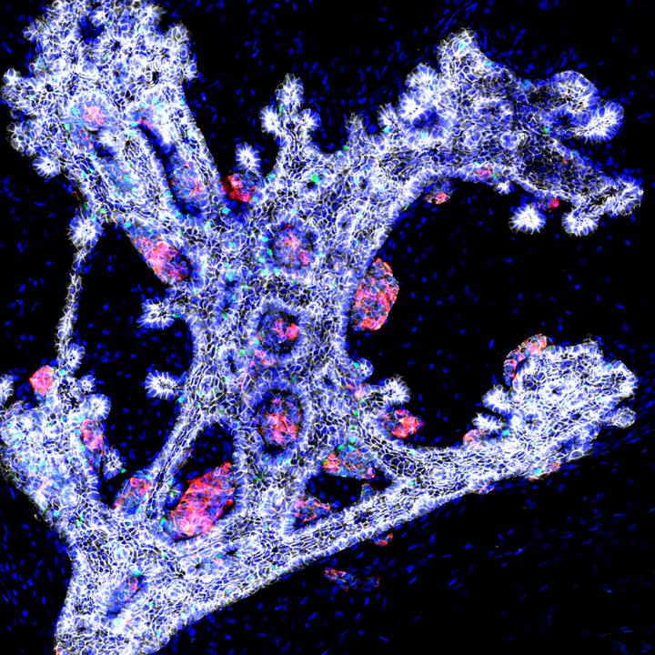 Pancreatic Bud