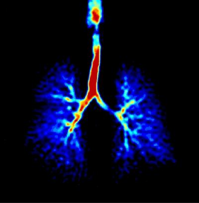 Healthy Lung