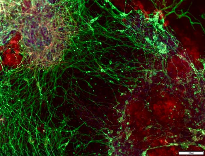 Neurons grown from stem cells in the lab form an interconnected network.