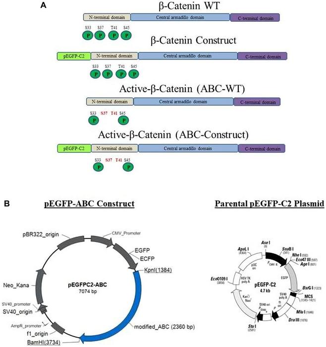 Active Beta-Catenin (ABC) promotes an invasive phenotype in pediatric osteosarcoma