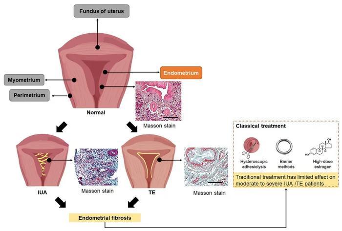 Figure 1. Endometrial regeneration defect diseases: IUA and TE.
