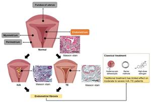 Figure 1. Endometrial regeneration defect diseases: IUA and TE.
