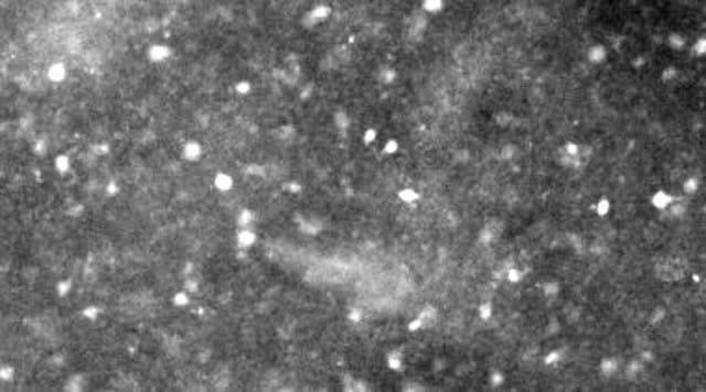 Fluorescent Calcium Imaging