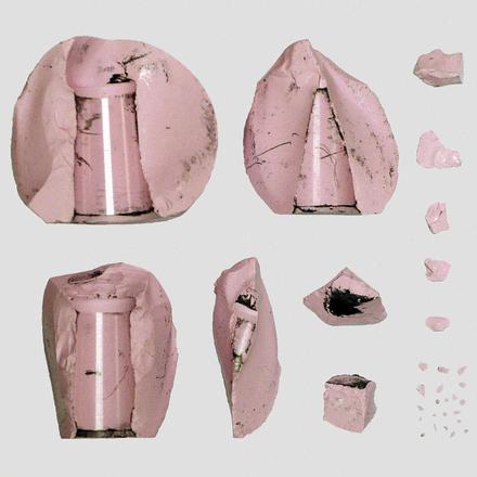 Ceramic Femoral-Head Fracture