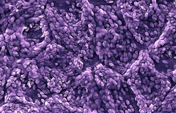Retinal Pigment Epithelial Cells Derived from Stem Cells