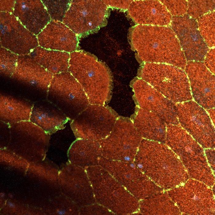 Two small wounds can be seen in the sheet of epithelial cells in this confocal image. Membranes (red), nuclei (blue) and actin (green). Image credit: Jocelyn Malamy