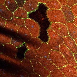 Two small wounds can be seen in the sheet of epithelial cells in this confocal image. Membranes (red), nuclei (blue) and actin (green). Image credit: Jocelyn Malamy