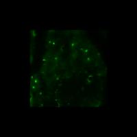 Cortical Astrocytes