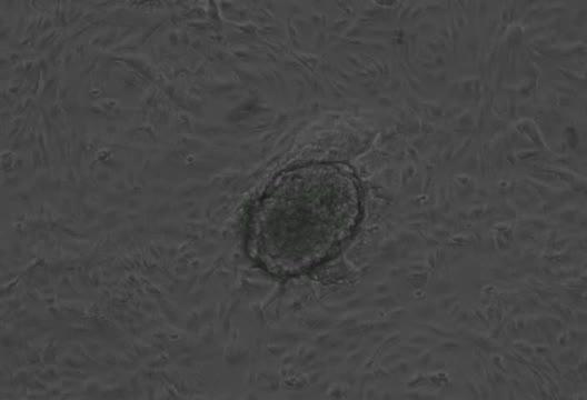 Chemically Reprogrammed Beating Heart Cell