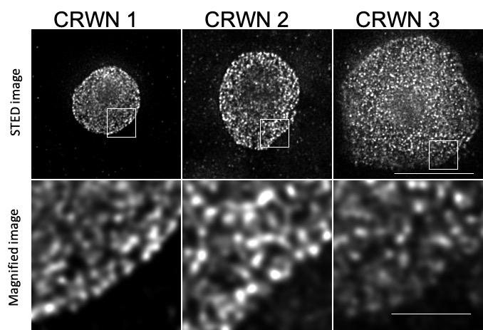 The Plant Cell Nuclear Lamina Is Built with a Web of Crowded Nuclei Proteins