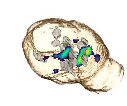 Growth Factor in Young Blood Benefits the Old (5 of 8)