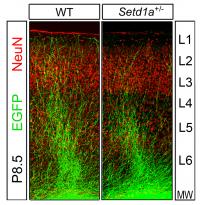 Setd1a Deficiency Disrupts Axonal Growth