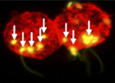 Spermatozoa Transmit HIV