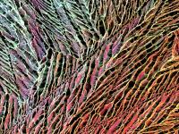 Injectable Cryogel-Based Whole-Cell Cancer Vaccines SEM