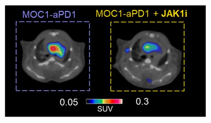 Dual PET Imaging Detects Tumor Progression and Heart Inflammation During Cancer Treatment