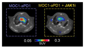 Dual PET Imaging Detects Tumor Progression and Heart Inflammation During Cancer Treatment